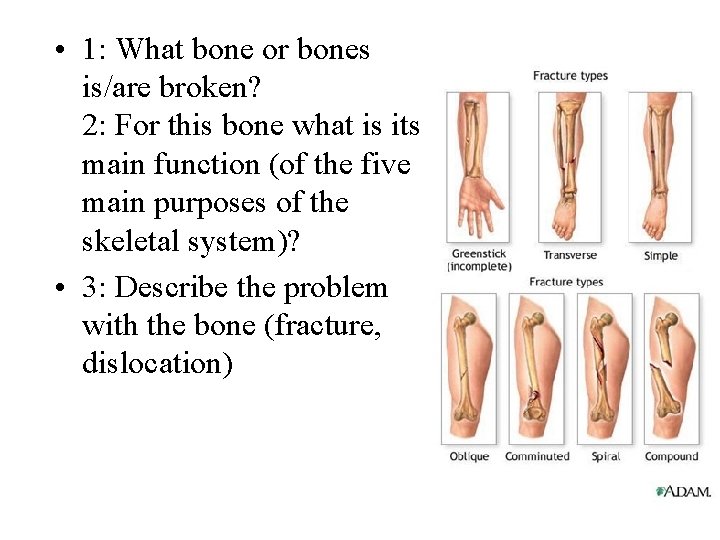  • 1: What bone or bones is/are broken? 2: For this bone what