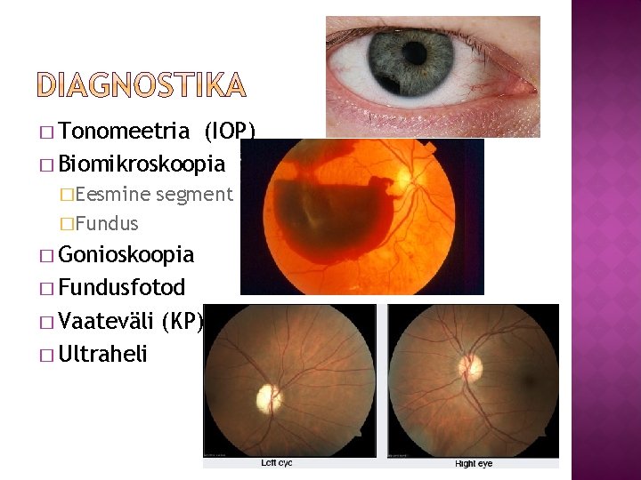 � Tonomeetria (IOP) � Biomikroskoopia �Eesmine segment �Fundus � Gonioskoopia � Fundusfotod � Vaateväli