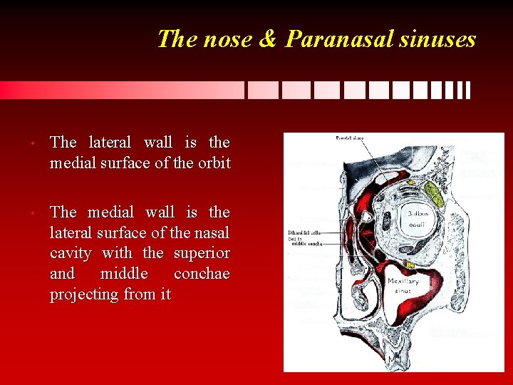 The nose & Paranasal sinuses • The lateral wall is the medial surface of