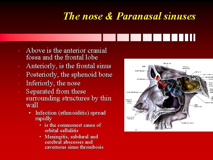 The nose & Paranasal sinuses • • • Above is the anterior cranial fossa