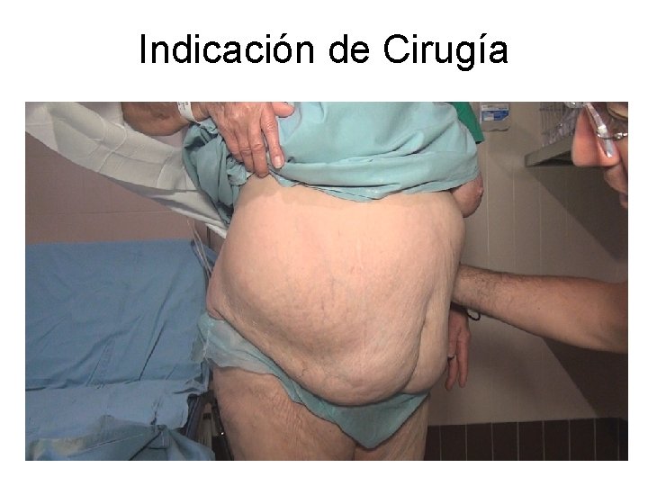 Indicación de Cirugía 