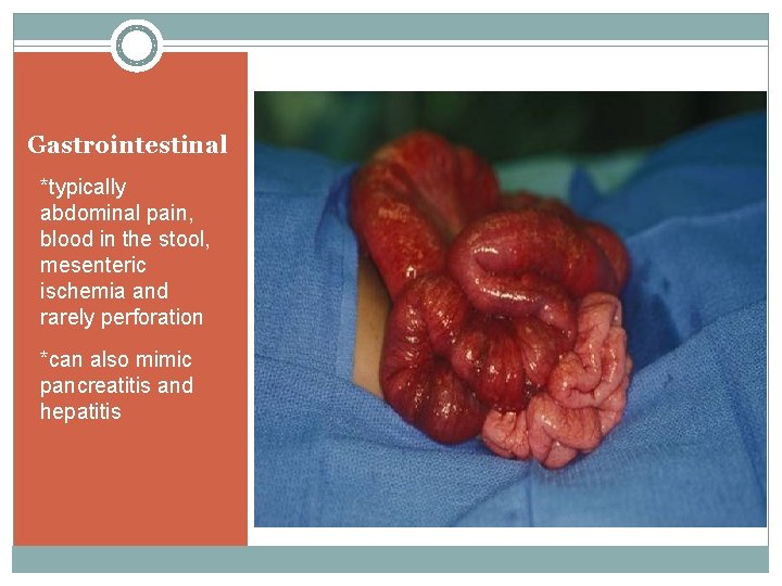 Gastrointestinal *typically abdominal pain, blood in the stool, mesenteric ischemia and rarely perforation *can