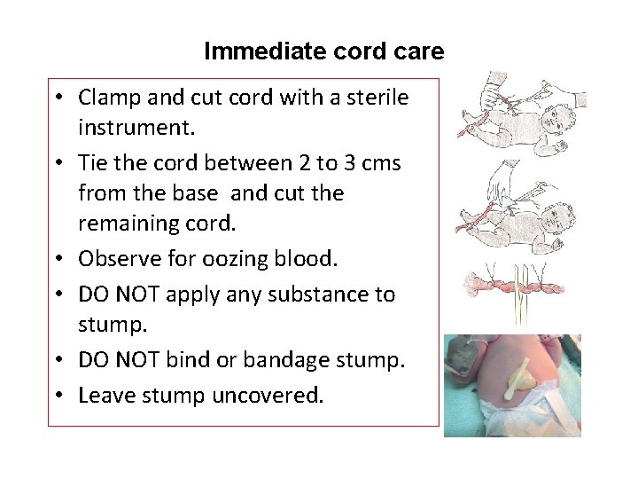 Immediate cord care • Clamp and cut cord with a sterile instrument. • Tie