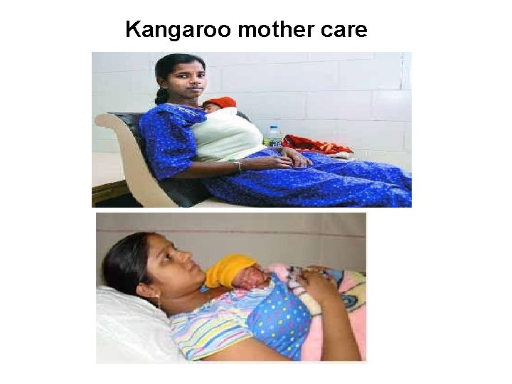 Kangaroo mother care 