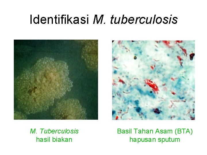 Identifikasi M. tuberculosis M. Tuberculosis hasil biakan Basil Tahan Asam (BTA) hapusan sputum 