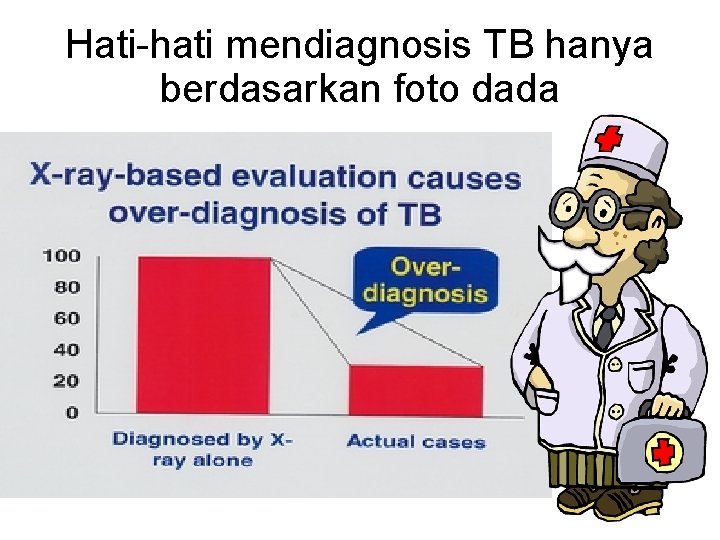 Hati-hati mendiagnosis TB hanya berdasarkan foto dada 