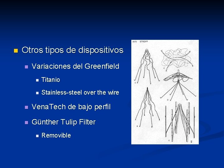 n Otros tipos de dispositivos n Variaciones del Greenfield n Titanio n Stainless-steel over