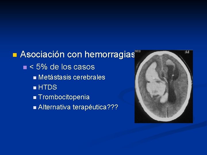 n Asociación con hemorragias n < 5% de los casos n Metástasis cerebrales n