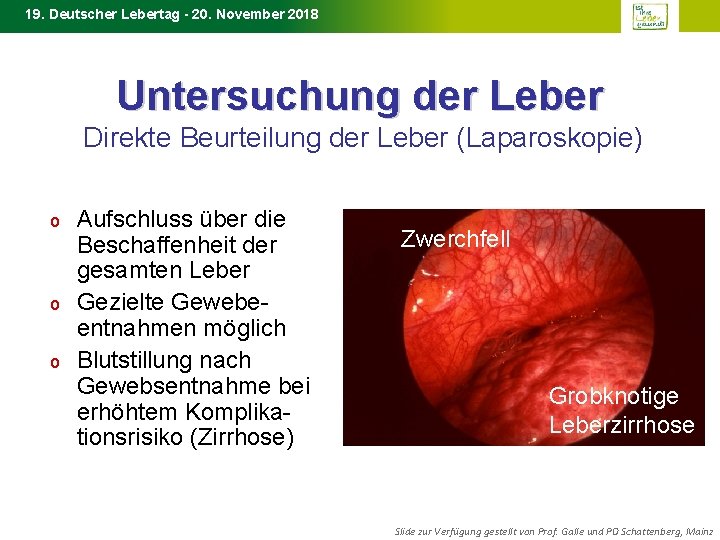 19. Deutscher Lebertag - 20. November 2018 Untersuchung der Leber Direkte Beurteilung der Leber