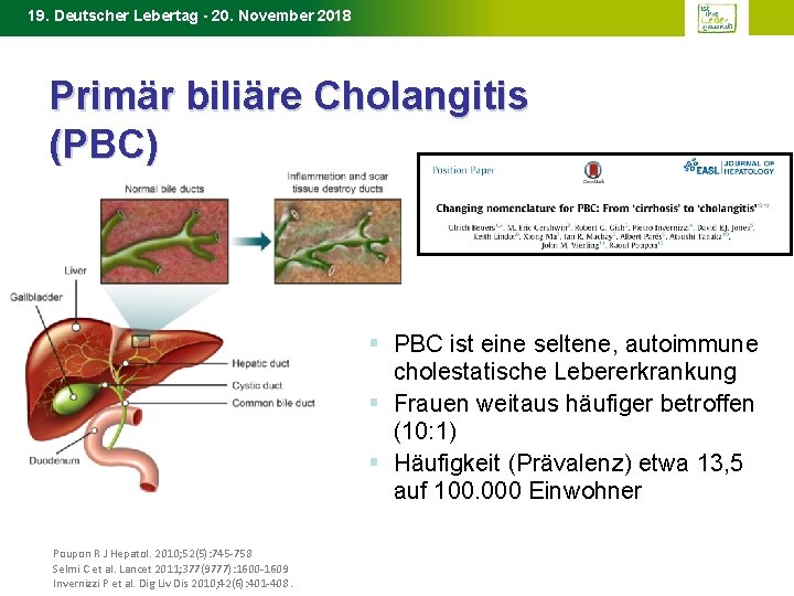 19. Deutscher Lebertag - 20. November 2018 Primär biliäre Cholangitis (PBC) § PBC ist