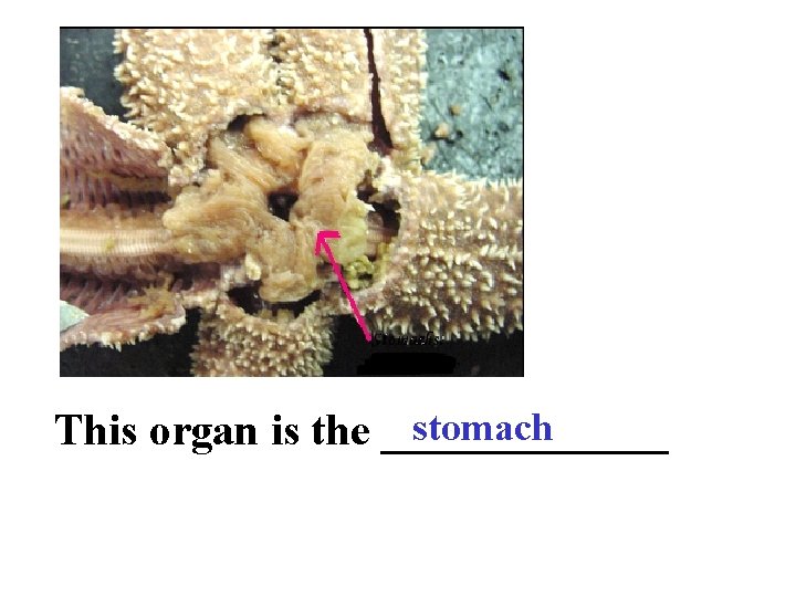 stomach This organ is the _______ 