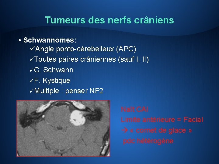 Tumeurs des nerfs crâniens • Schwannomes: üAngle ponto-cérebelleux (APC) üToutes paires crâniennes (sauf I,