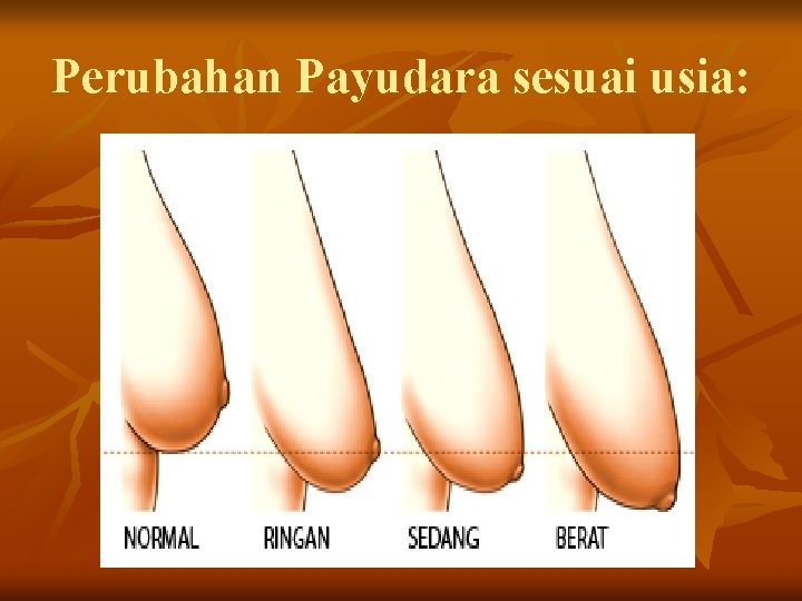 Perubahan Payudara sesuai usia: 