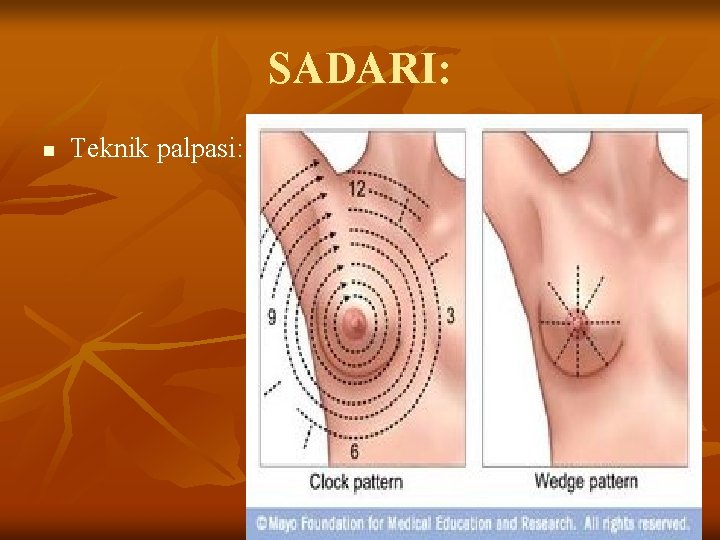 SADARI: n Teknik palpasi: 