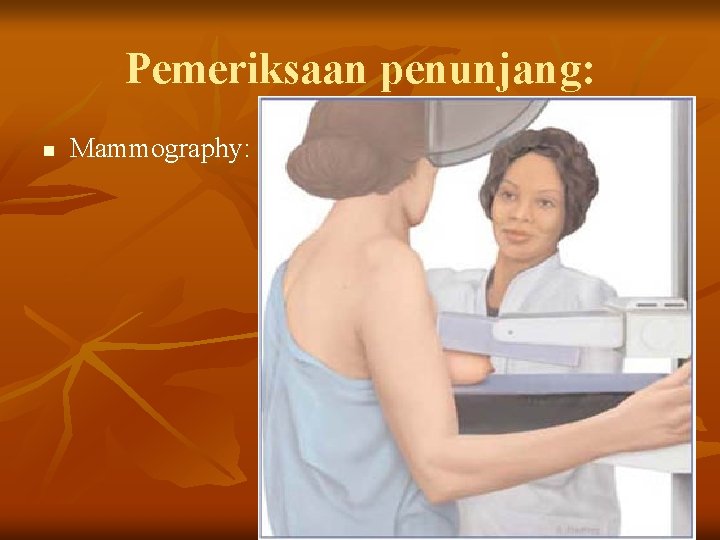 Pemeriksaan penunjang: n Mammography: 