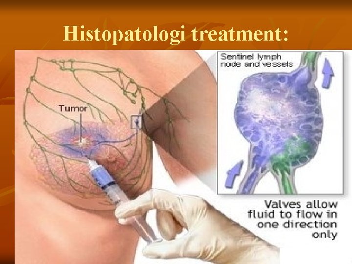 Histopatologi treatment: 
