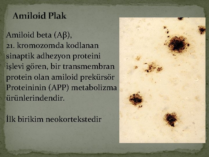 Amiloid Plak Amiloid beta (Aβ), 21. kromozomda kodlanan sinaptik adhezyon proteini işlevi gören, bir