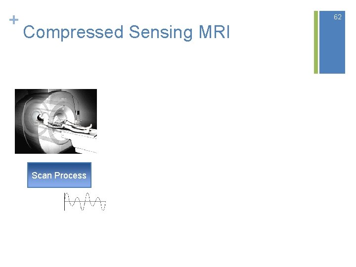 + 62 Compressed Sensing MRI Scan Process + 62 Compressed Sensing MRI Scan Process