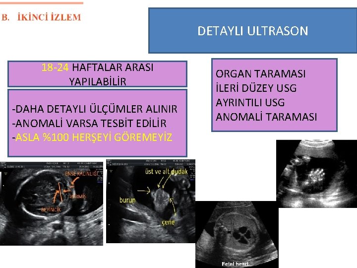 DETAYLI ULTRASON 18 -24 HAFTALAR ARASI YAPILABİLİR -DAHA DETAYLI ÜLÇÜMLER ALINIR -ANOMALİ VARSA TESBİT
