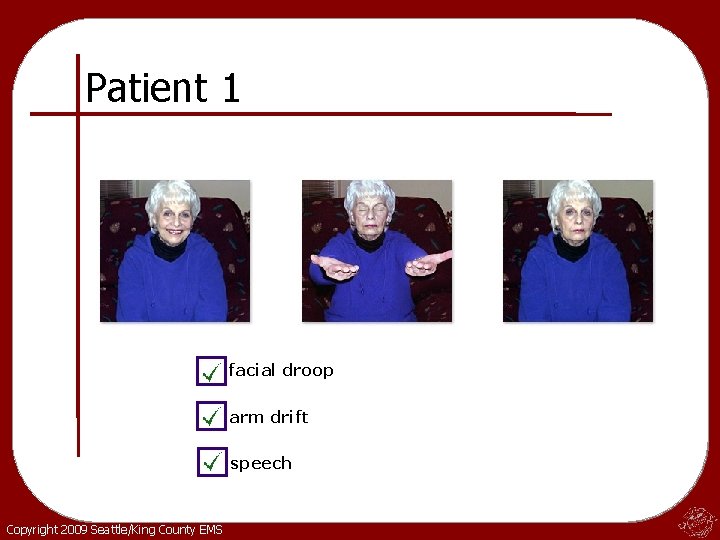 Patient 1 facial droop arm drift speech Copyright 2009 Seattle/King County EMS 