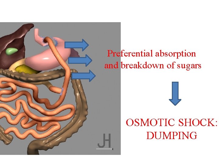Preferential absorption and breakdown of sugars OSMOTIC SHOCK: DUMPING 