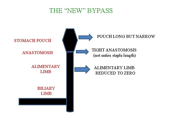 THE “NEW” BYPASS STOMACH POUCH ANASTOMOSIS ALIMENTARY LIMB BILIARY LIMB POUCH LONG BUT NARROW