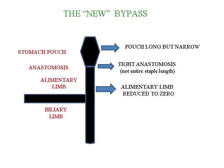 THE “NEW” BYPASS STOMACH POUCH ANASTOMOSIS ALIMENTARY LIMB BILIARY LIMB POUCH LONG BUT NARROW