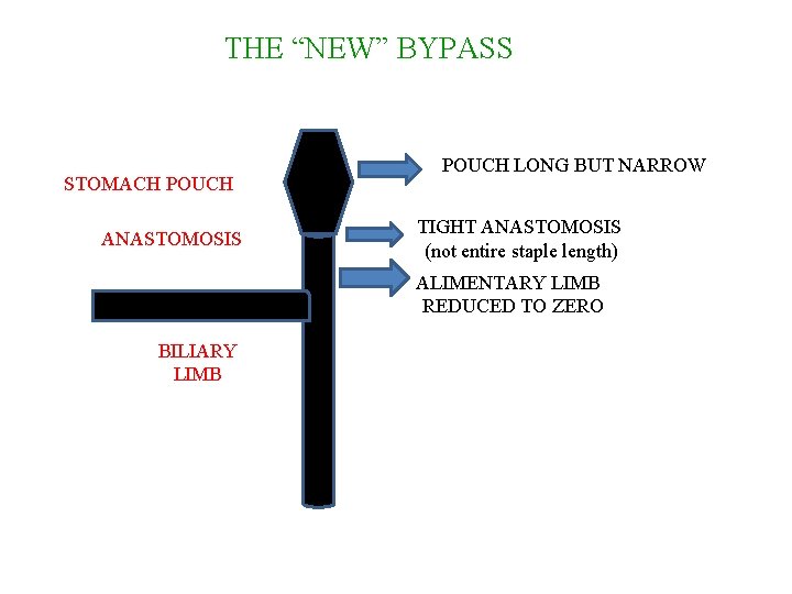 THE “NEW” BYPASS STOMACH POUCH ANASTOMOSIS POUCH LONG BUT NARROW TIGHT ANASTOMOSIS (not entire