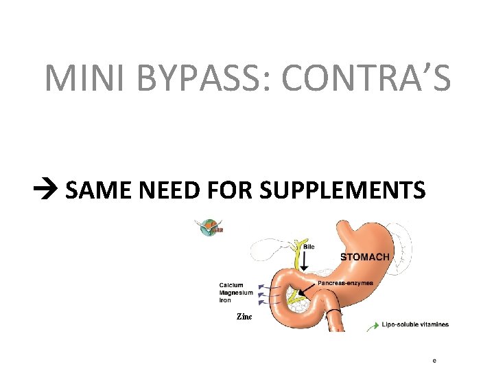 MINI BYPASS: CONTRA’S SAME NEED FOR SUPPLEMENTS Zinc 