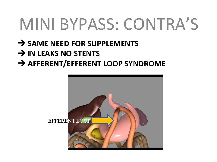 MINI BYPASS: CONTRA’S SAME NEED FOR SUPPLEMENTS IN LEAKS NO STENTS AFFERENT/EFFERENT LOOP SYNDROME