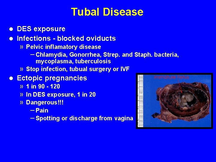 Tubal Disease DES exposure l Infections - blocked oviducts l » » l Pelvic