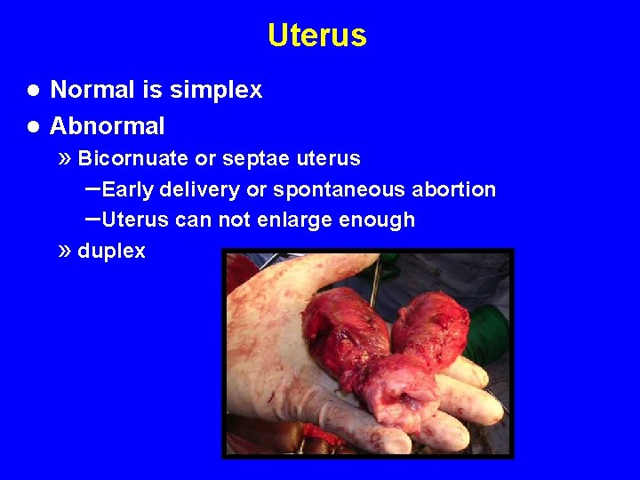 Uterus Normal is simplex l Abnormal l » Bicornuate or septae uterus – Early