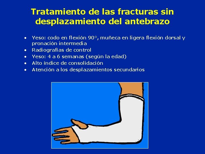 Tratamiento de las fracturas sin desplazamiento del antebrazo • • • Yeso: codo en