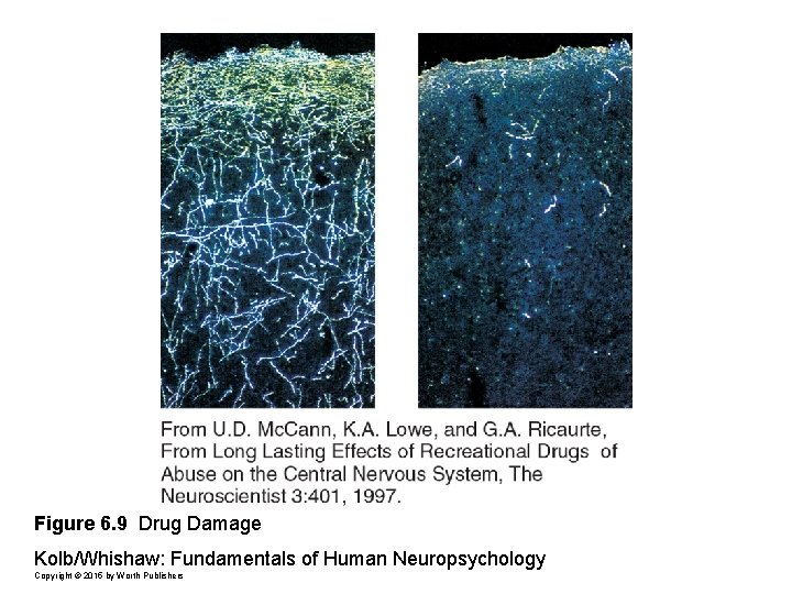 Figure 6. 9 Drug Damage Kolb/Whishaw: Fundamentals of Human Neuropsychology Copyright © 2015 by