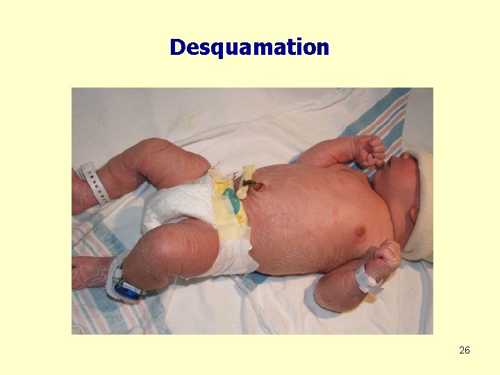 Desquamation 26 