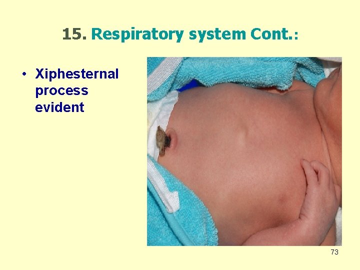 15. Respiratory system Cont. : • Xiphesternal process evident 73 