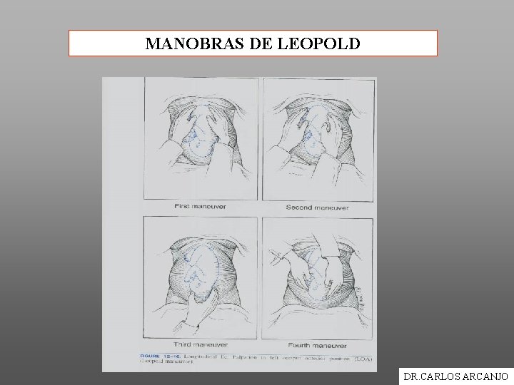 MANOBRAS DE LEOPOLD DR. CARLOS ARCANJO 
