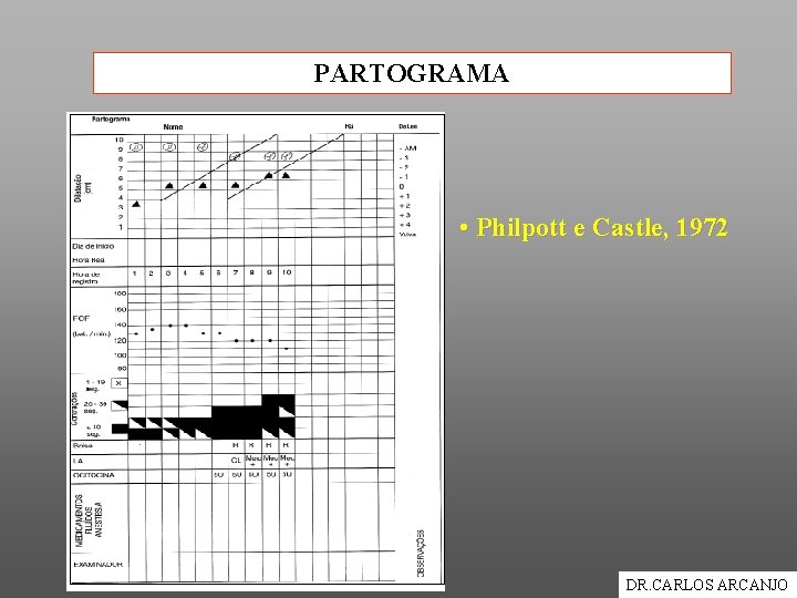 PARTOGRAMA • Philpott e Castle, 1972 DR. CARLOS ARCANJO 