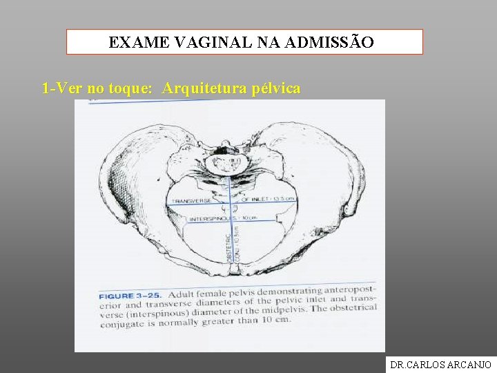 EXAME VAGINAL NA ADMISSÃO 1 -Ver no toque: Arquitetura pélvica DR. CARLOS ARCANJO 