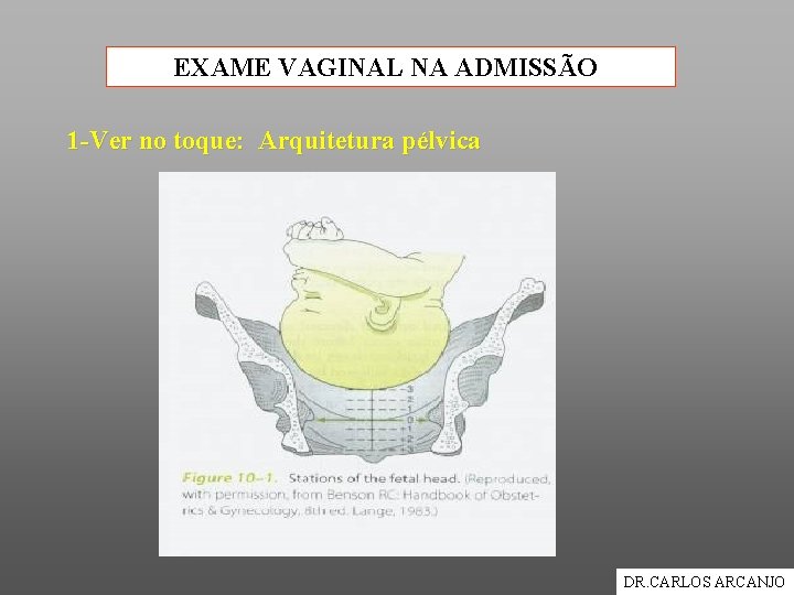 EXAME VAGINAL NA ADMISSÃO 1 -Ver no toque: Arquitetura pélvica DR. CARLOS ARCANJO 