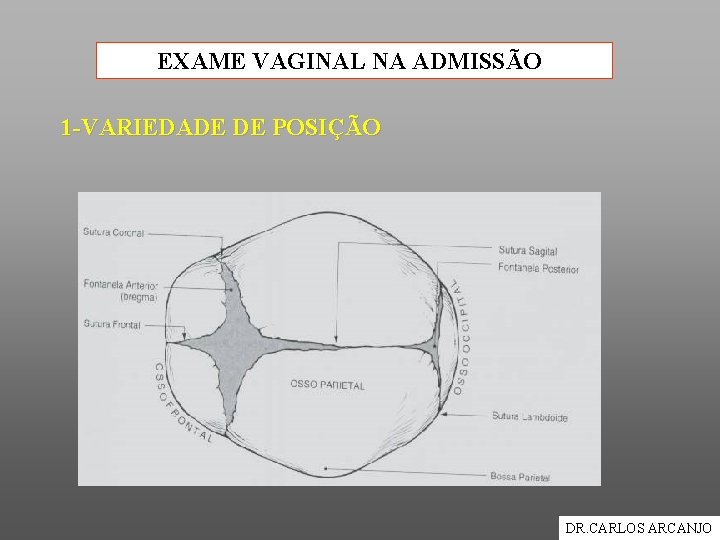 EXAME VAGINAL NA ADMISSÃO 1 -VARIEDADE DE POSIÇÃO DR. CARLOS ARCANJO 