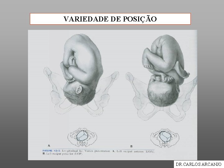 VARIEDADE DE POSIÇÃO DR. CARLOS ARCANJO 