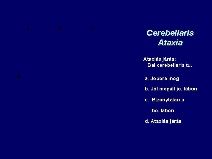 a b c Cerebellaris Ataxia Ataxiás járás: Bal cerebellaris tu. d a. Jobbra inog