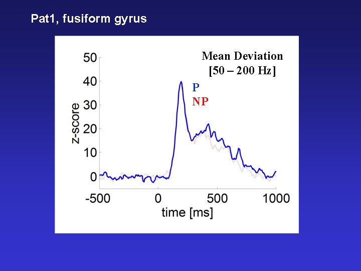 Pat 1, fusiform gyrus Mean Deviation [50 – 200 Hz] P NP 