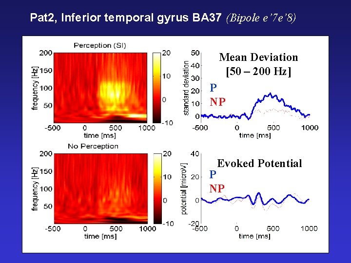 Pat 2, Inferior temporal gyrus BA 37 (Bipole e’ 7 e’ 8) Mean Deviation