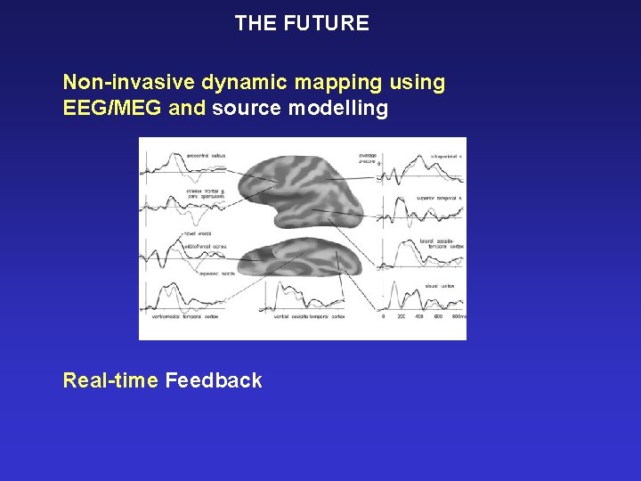 THE FUTURE Non-invasive dynamic mapping using EEG/MEG and source modelling Real-time Feedback 