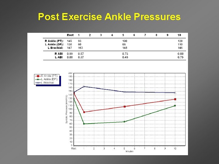 Post Exercise Ankle Pressures 
