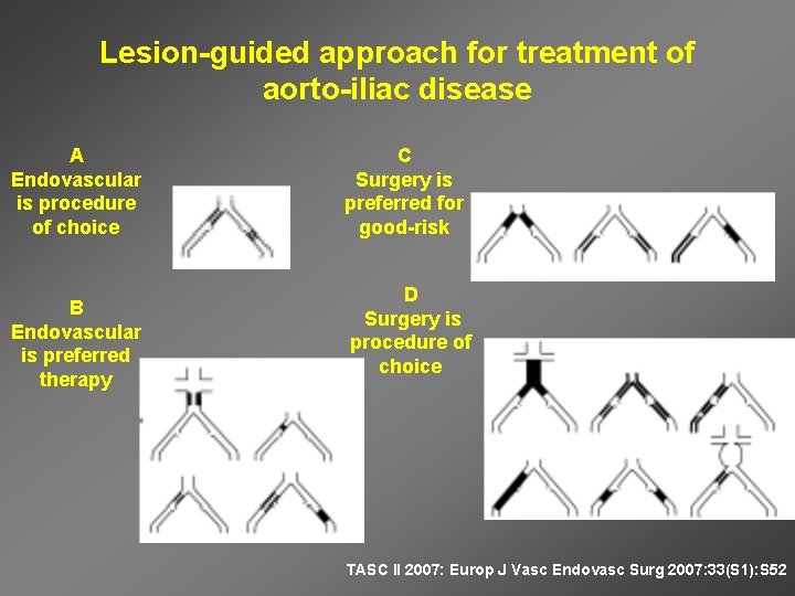 Lesion-guided approach for treatment of aorto-iliac disease A Endovascular is procedure of choice B