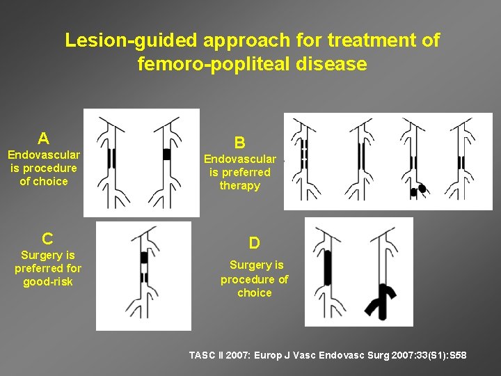 Lesion-guided approach for treatment of femoro-popliteal disease A Endovascular is procedure of choice C