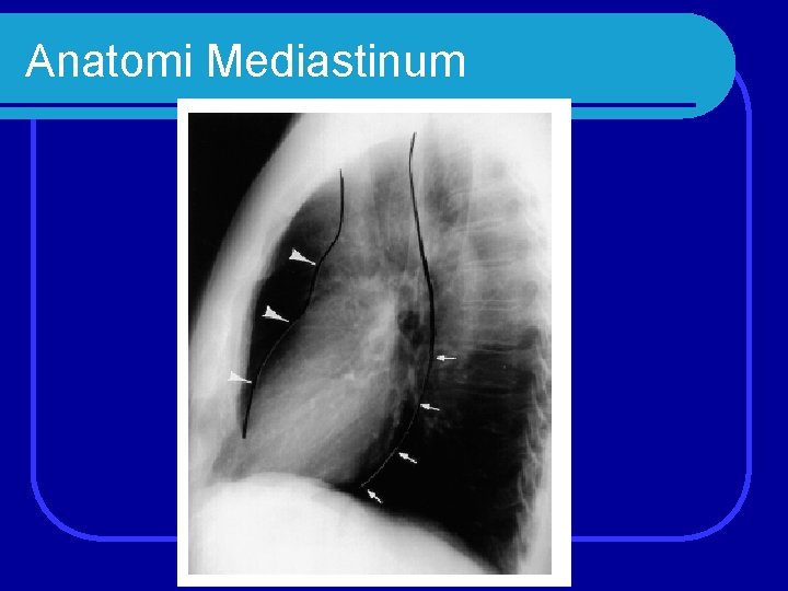 Anatomi Mediastinum 